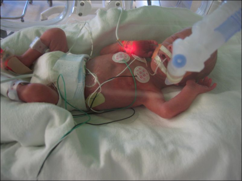 Sebastian with Respirator